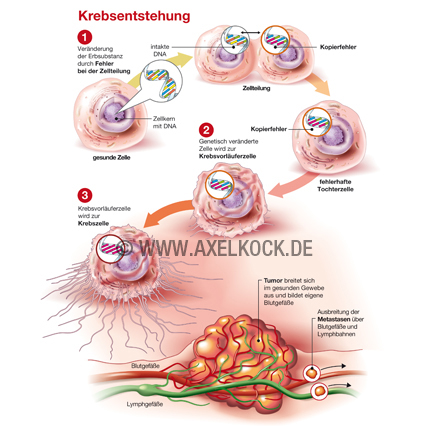 Krebsentstehung