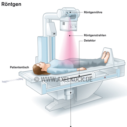 Röntgen