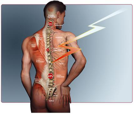 Rückenschmerzen
