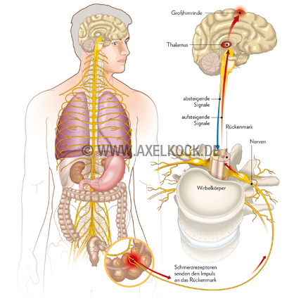 Schmerzentstehung