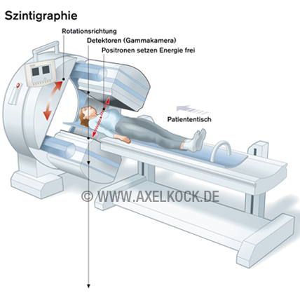 Szintigraphie