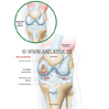 Kniegelenk-Arthrose