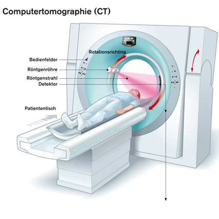 Computertomographie