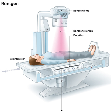 Röntgen