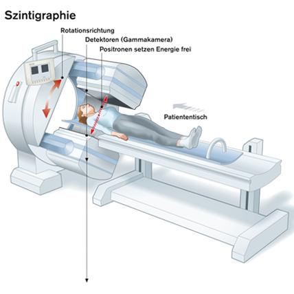 Szintigraphie