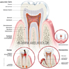 Zahnerkrankungen